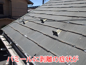 パミールの剥離が起きています