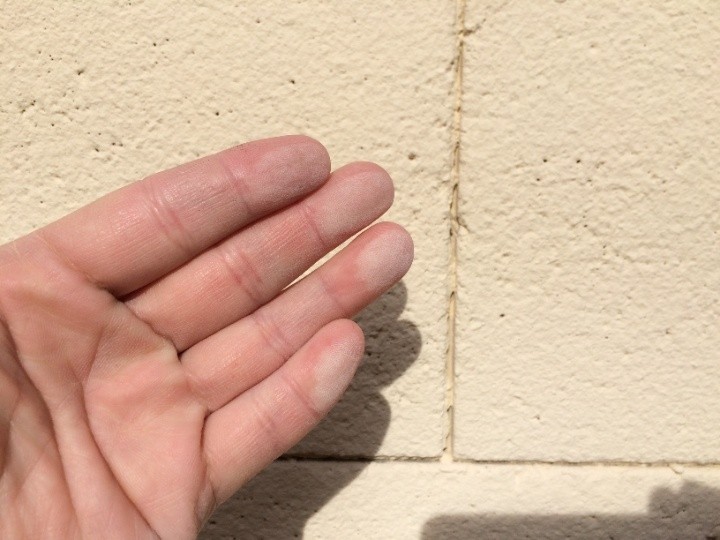 チョーキング症状